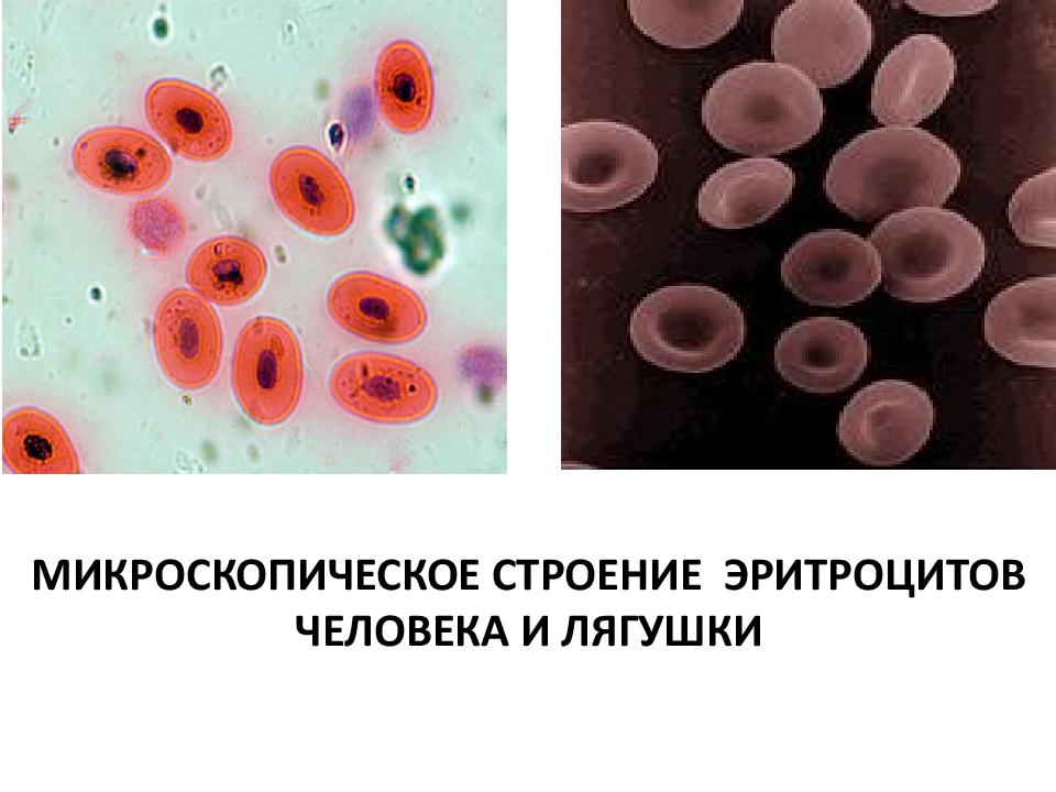 Микроскопическое строение человека и лягушки. Строение эритроцита крови лягушки. Микроскопическое строение эритроцитов лягушки. Форма эритроцитов в крови лягушки. Строение крови человека с кровью лягушки.