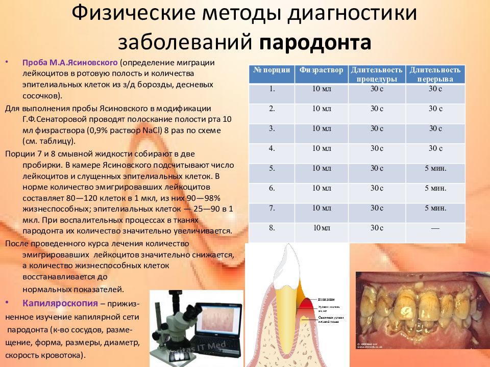 Обследование пародонта. Методы выявления заболеваний пародонта. Методы исследования при заболеваниях пародонта. Диагностическая значимость методов обследования тканей пародонта. Методы диагностики пародонтита.