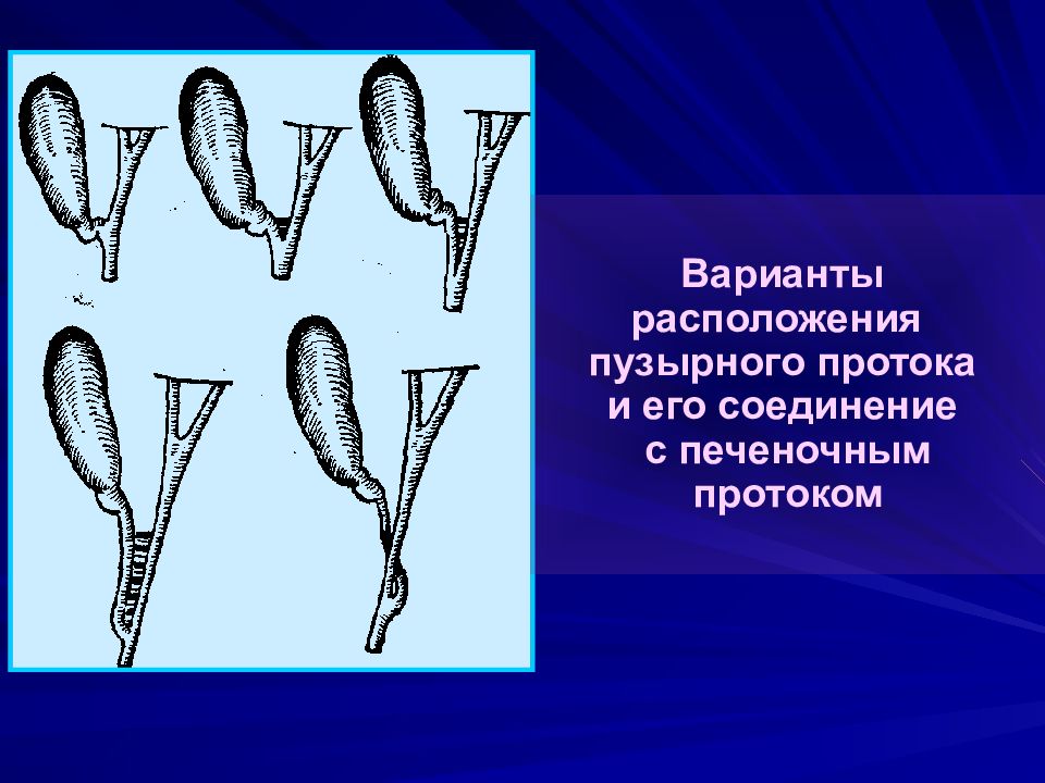 Механическая желтуха презентация по хирургии