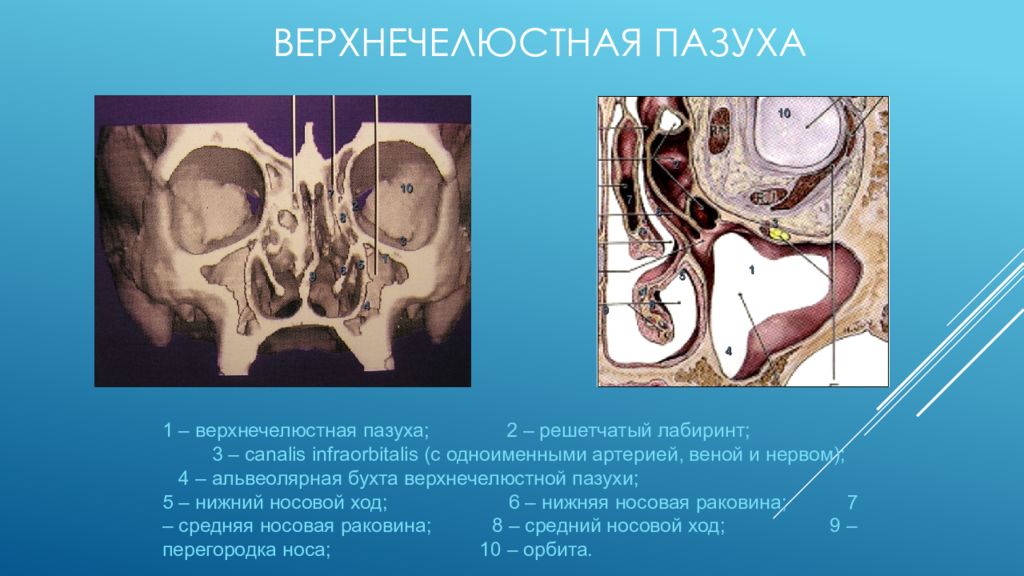 Решетчатый лабиринт. Строение верхнечелюстной пазухи. Кровоснабжение гайморовой пазухи. Стенки решетчатого Лабиринта.