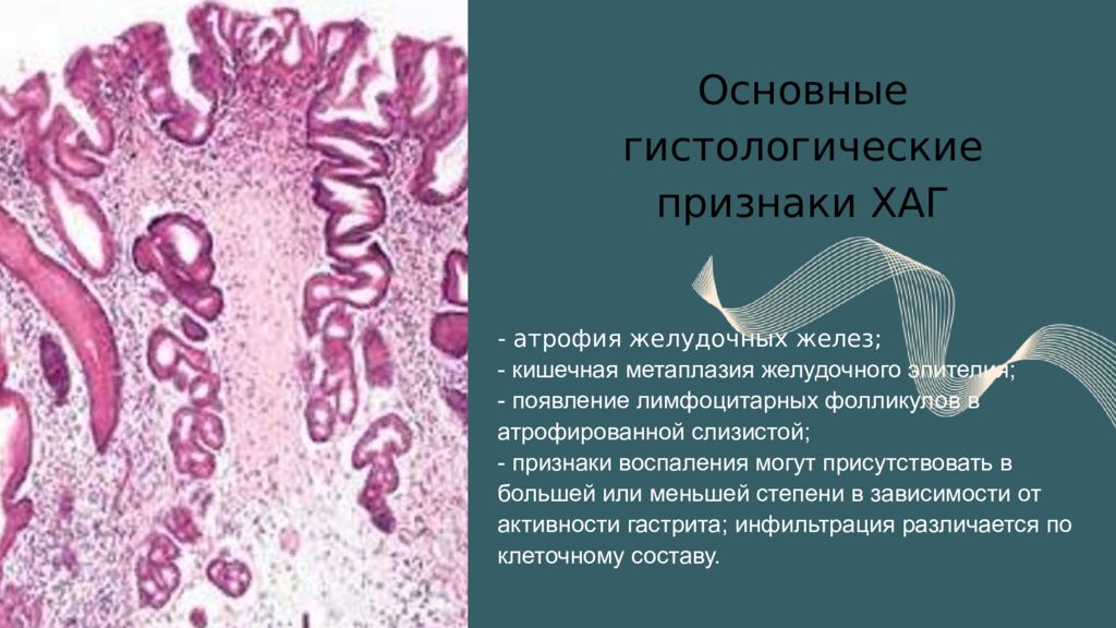 Стол 2 при гастрите атрофическом гастрите