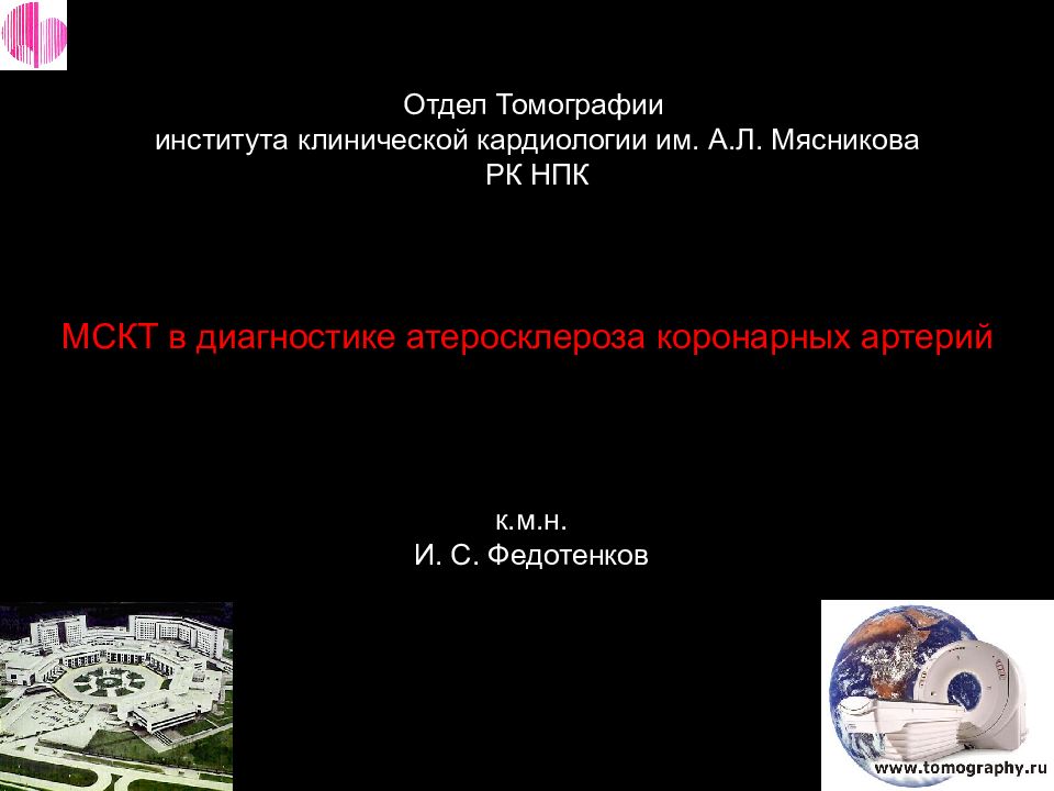 МСКТ в диагностике атеросклероза коронарных артерий Отдел Томографии института