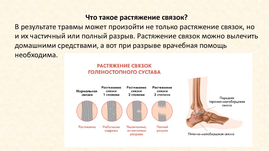 Вывихи ушибы переломы презентация