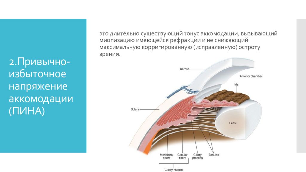 Длительно существующий. Привычно-избыточное напряжение аккомодации (пина). Привычное напряжение аккомодации. Пина аккомодация. Привычно избыточное напряжение аккомодации симптомы.