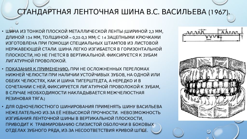 При переломе челюсти шинирование схема