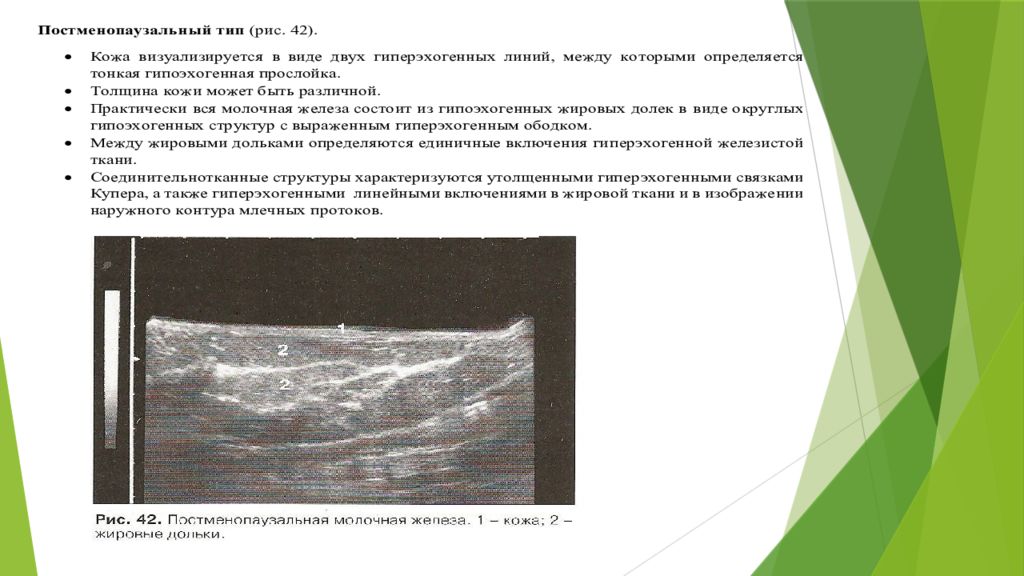 Жировая инволюция молочных желез что. Премаммарная клетчатка молочной железы норма УЗИ. Молочные железы инволютивные изменения протокол УЗИ. Строение молочной железы на УЗИ. УЗИ молочных желез методика.