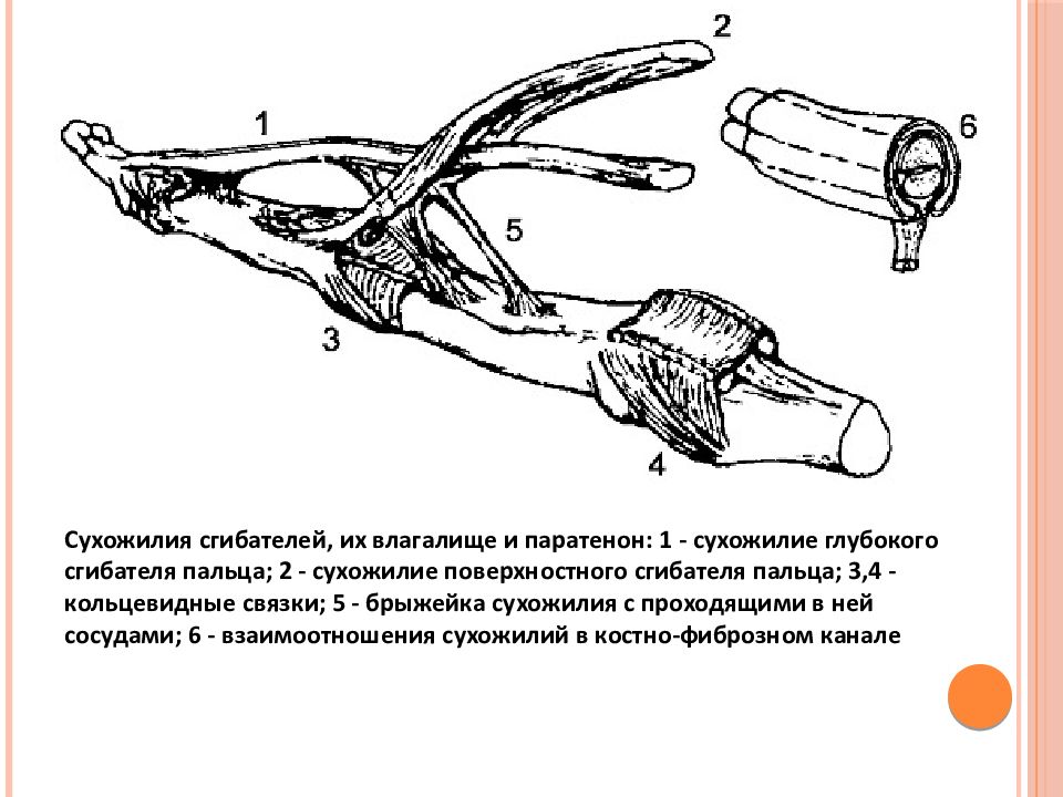 Повреждения сухожилий кисти презентация