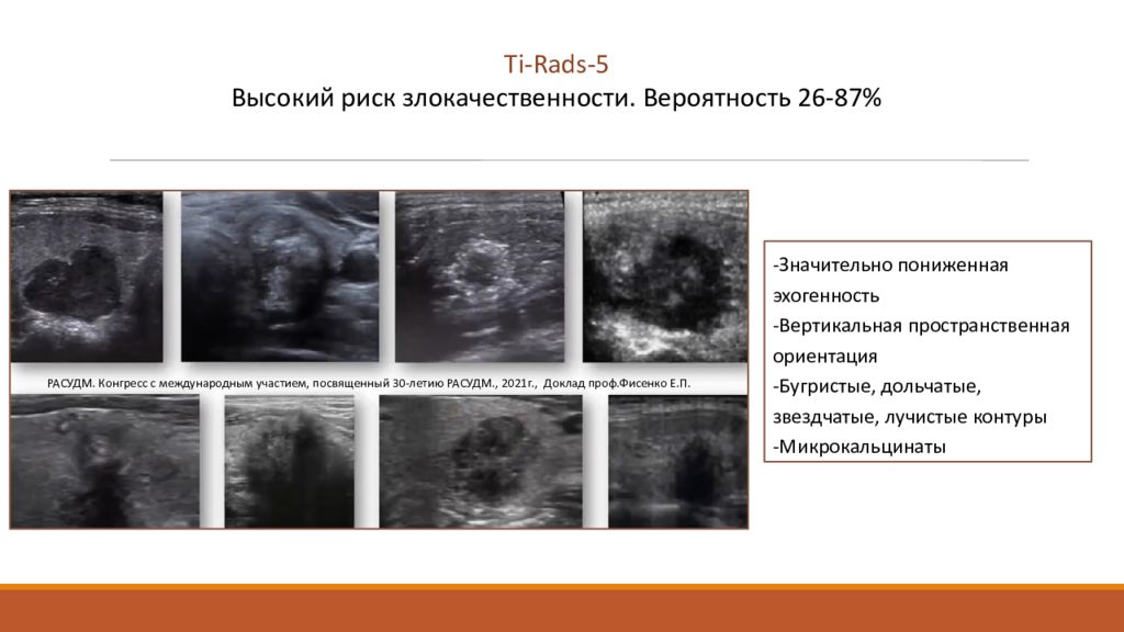 Rads r. Тирадс 2 классификация узлов щитовидной железы. Классификация Tirads щитовидная железа УЗИ. Шкала тирадс. Система Tirads.