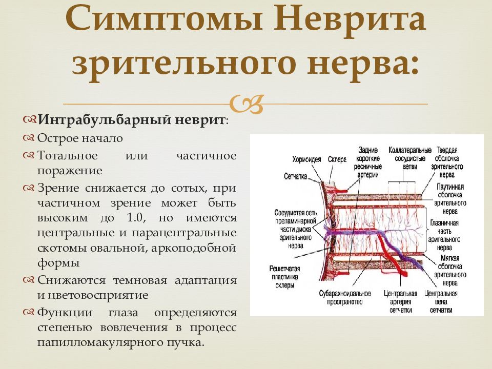 Неврит зрительного нерва презентация