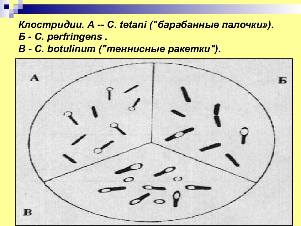 Кластридии. Морфология клостридии перфрингенс. Клостридии перфрингенс антибиотики. Клостридии перфрингенс микроскоп. Clostridium botulinum окраска.