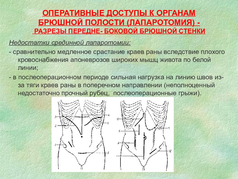 Абсцесс передней брюшной стенки карта вызова