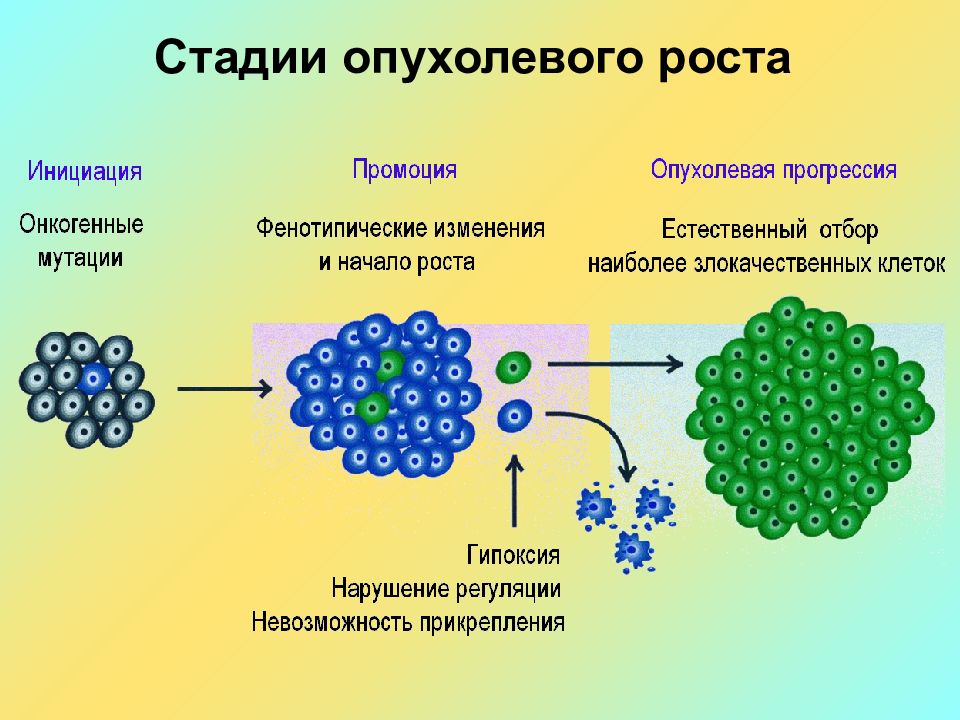 Виды опухолевого роста схема