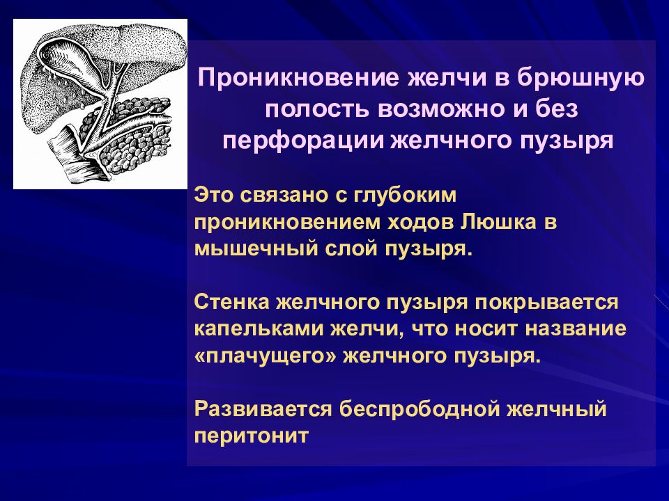 Проникновение. Перфорация желчного пузыря перитонит. Ходы Люшка желчного пузыря. Ходы Люшка желчного пузыря гистология. Перфорация стенки желчного пузыря.