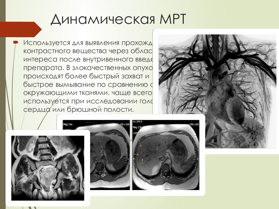 Контраст для мрт. Динамическая мрт. Контрастные вещества для мрт. Введение контрастного вещества при мрт. Мрт с введением контрастного вещества.