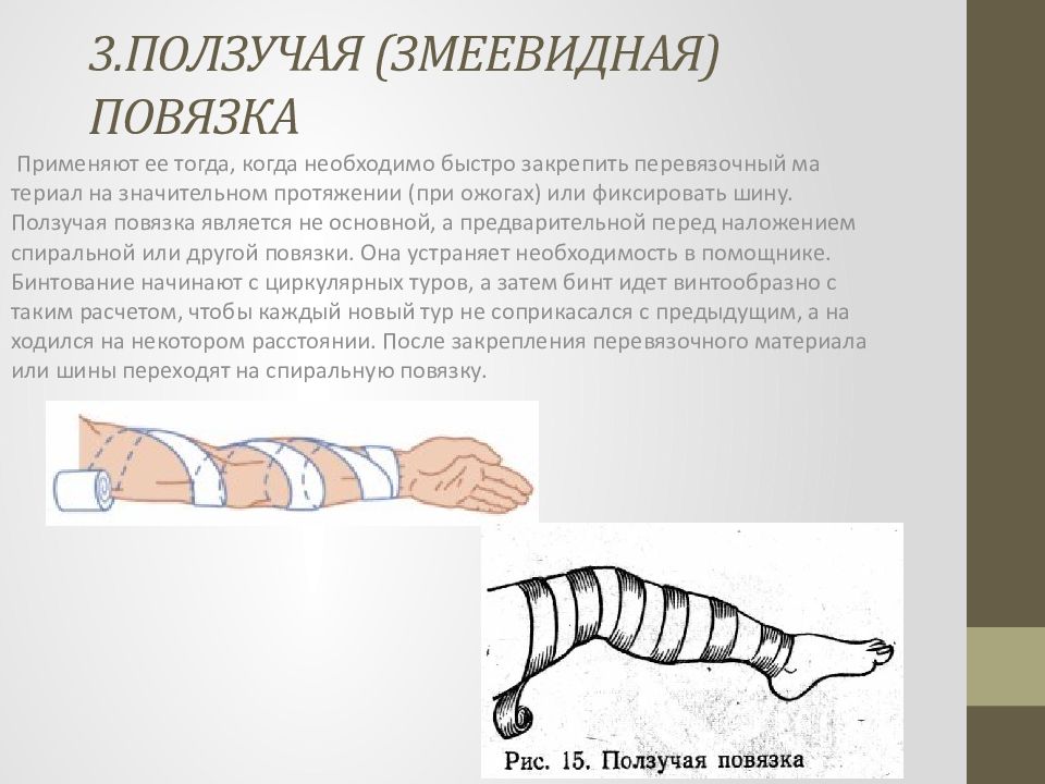 Виды повязок и правила их наложения презентация