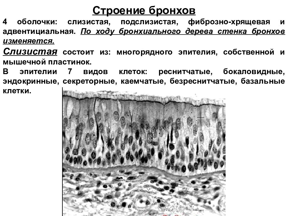 Оболочки бронхов. Эпителий бронхов гистология. Строение бронхиального дерева гистология. Эпителий бронхиального дерева гистология. Слизистая оболочка бронхов гистология.