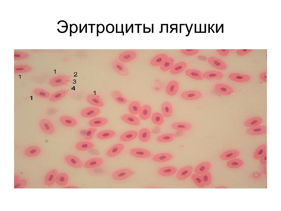 Эритроциты человека и лягушки. Микропрепарат эритроциты лягушки. Эритроциты в крови лягушки под микроскопом. Эритроциты в крови лягушки рисунок. Строение эритроцита крови лягушки.