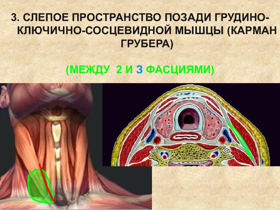 Презентация топографическая анатомия