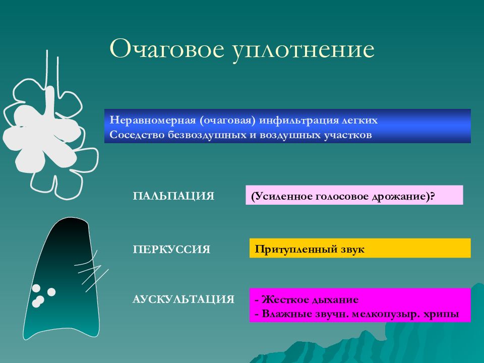 Очаговое уплотнение аускультация. Очаговое уплотнение звук перкуторный. Перкуссия очаговое уплотнение. Инфильтрация легочной ткани.