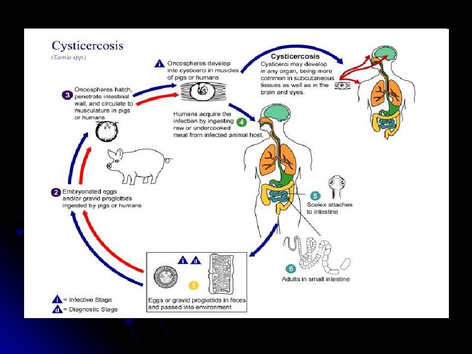 Каким образом человек может заразиться тениозом. Тениидозы цистицеркоз. Жизненный цикл тениоза и цистицеркоза. Цистицеркоз презентация.