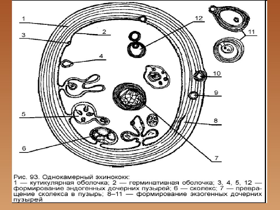 Цифрой обозначено на рисунке яйцо эхинококка. Однокамерный эхинококк. Ларвальные цестодозы. Эхинококк строение.