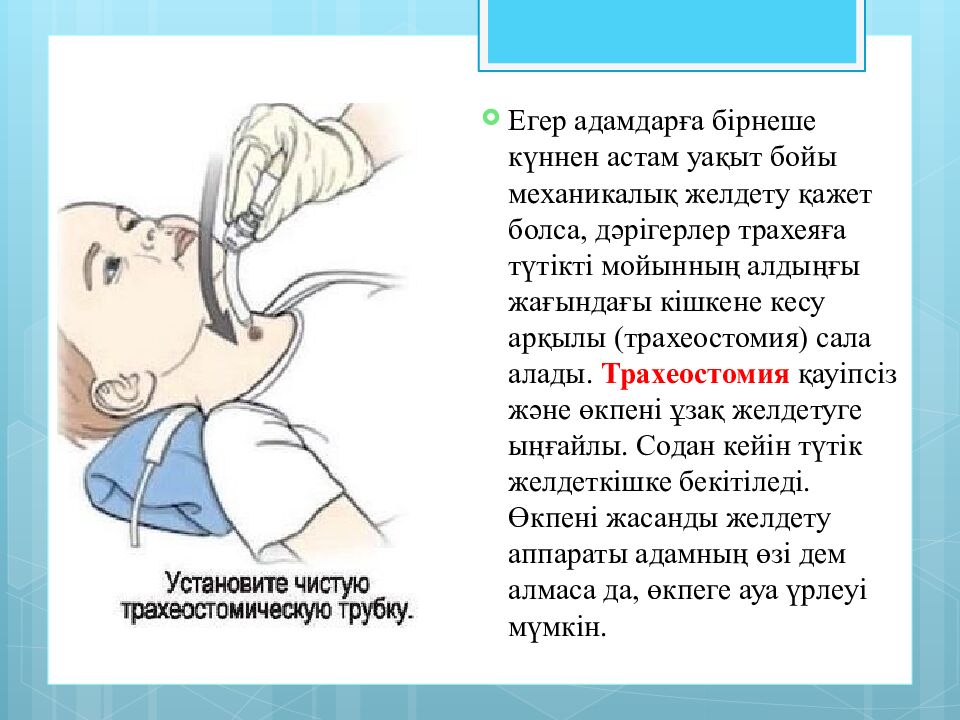 Тақырыбы:Жүрек-өкпе реанимациясы.Мәйітпен жұмыс жасау ережелері