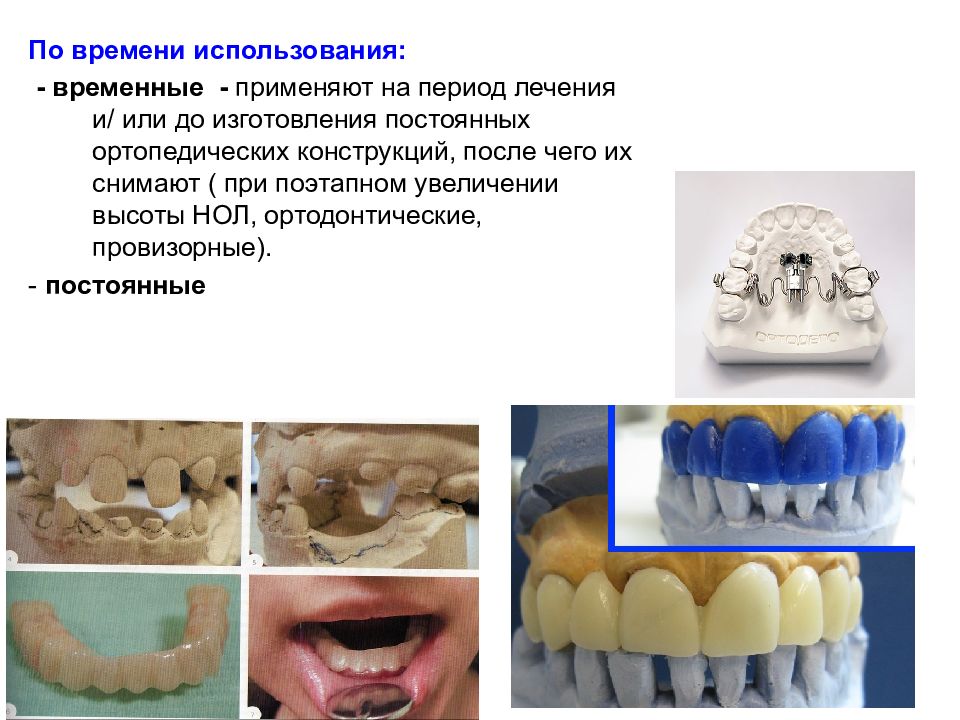 Искусственные коронки презентация