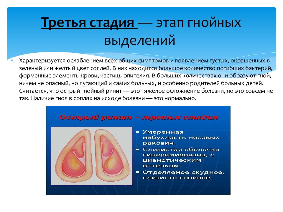 Острый и хронический ринит презентация