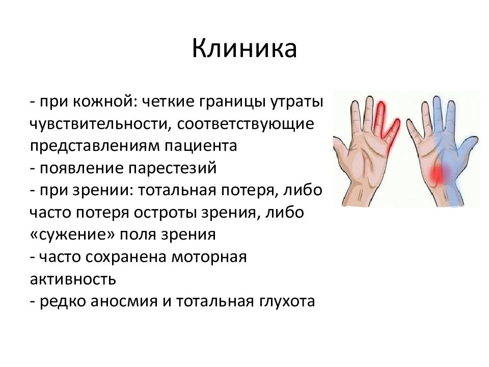 Утрата чувствительности. Диссоциативные расстройства чувствительности. Диссоциативное расстройство чувствительности. Диссоциативная фуга картинки.