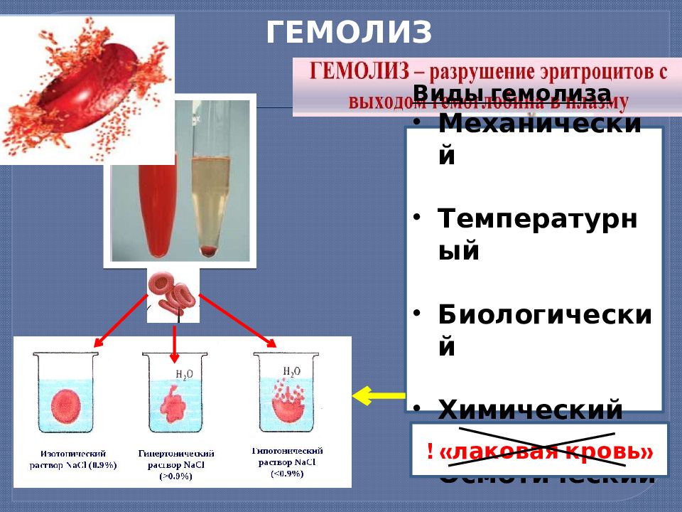 Разрыв среды. Причины осмотического гемолиза. Гемолиз физиология. Гемолиз эритроцитов лаковая кровь. Гемолиз разрушение эритроцитов.