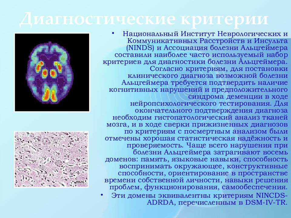 Картинки от болезни альцгеймера