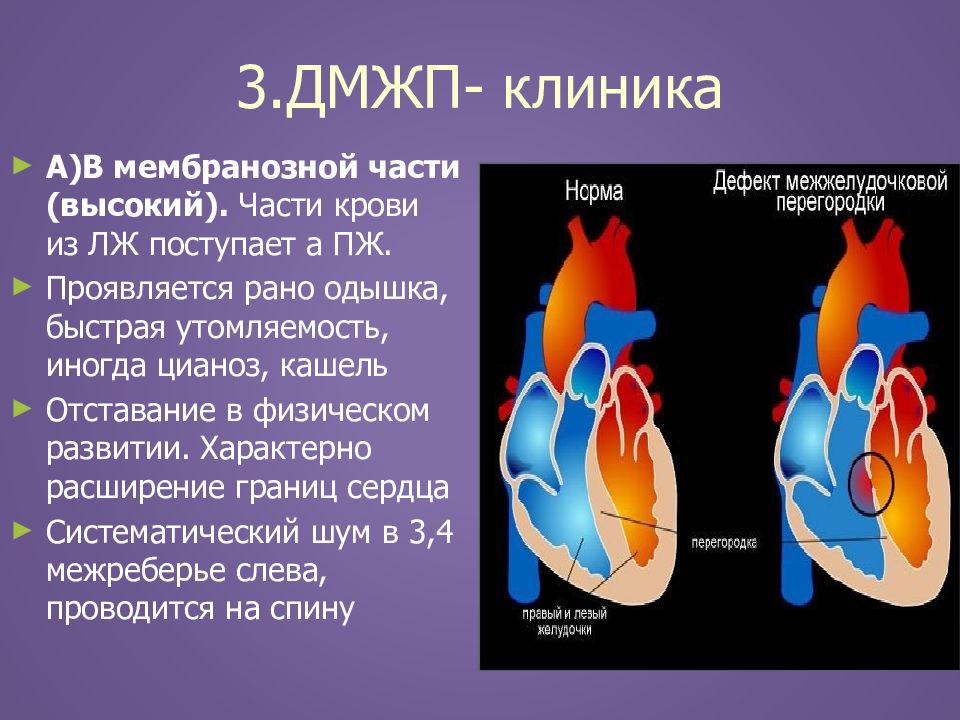 Впс у детей педиатрия презентация