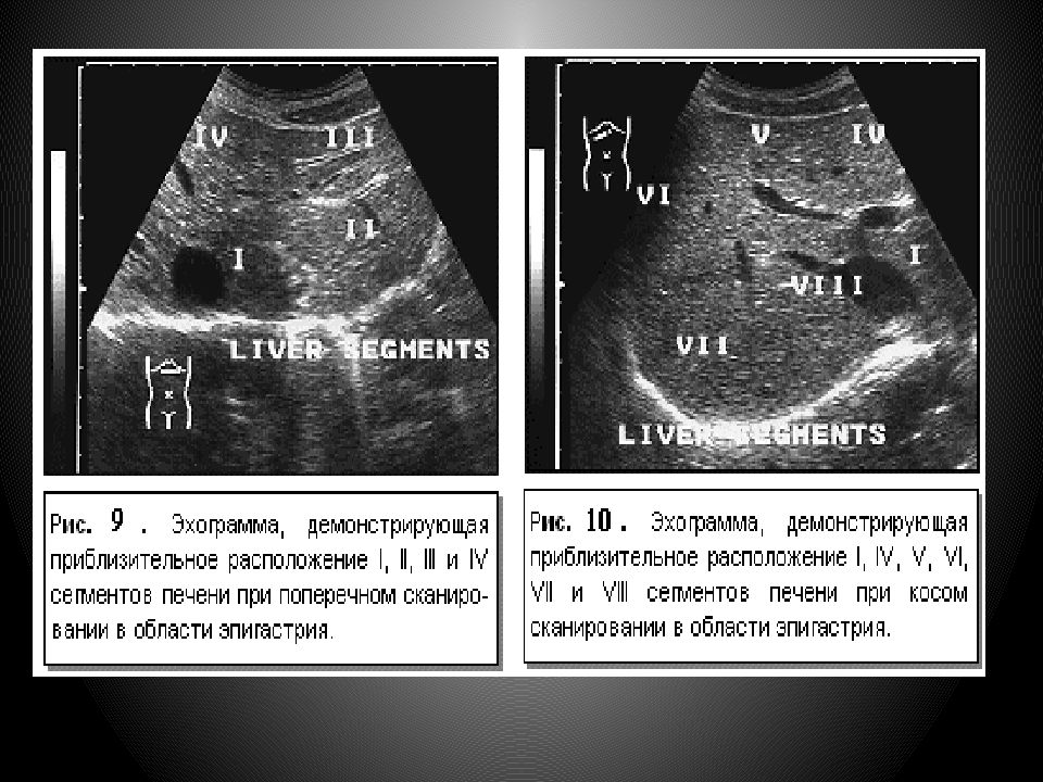 Узи брюшной полости схема