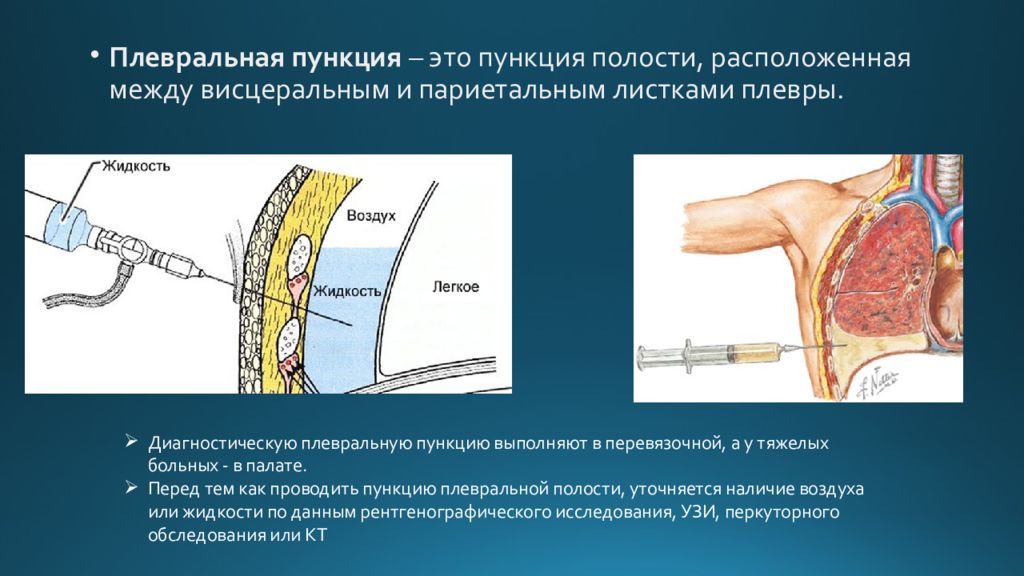 Пункция полостей