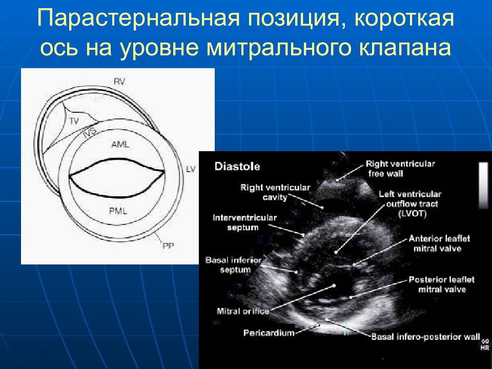 Сегменты сердца на узи схема