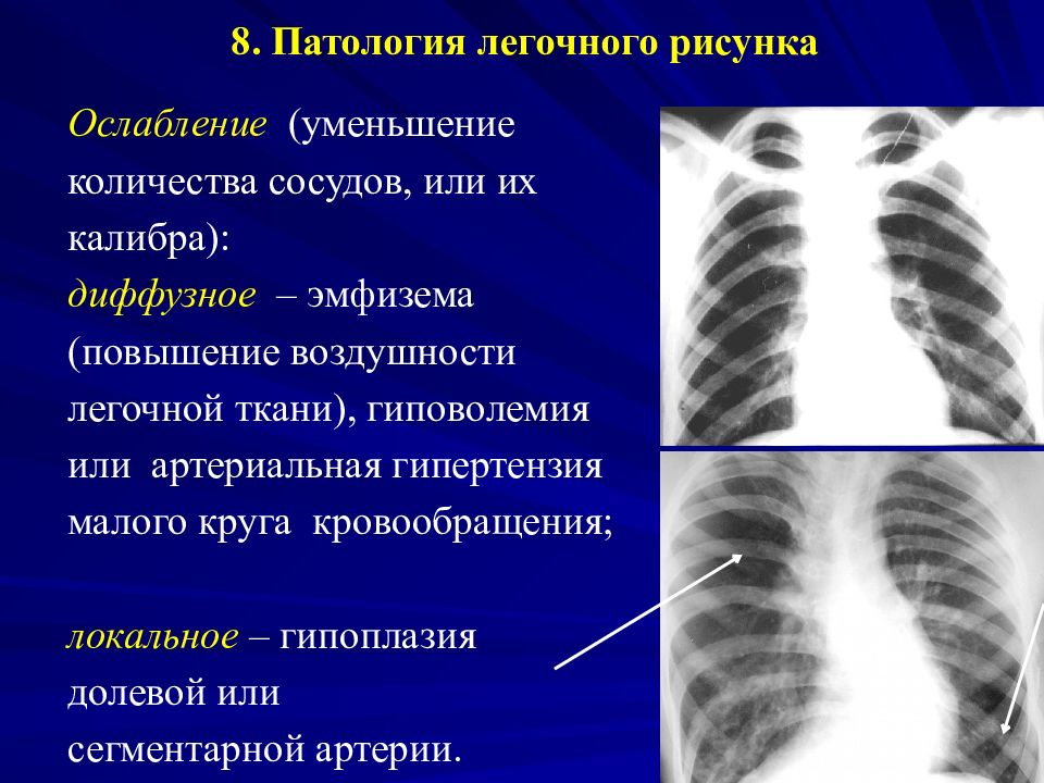 Картинки по патологии