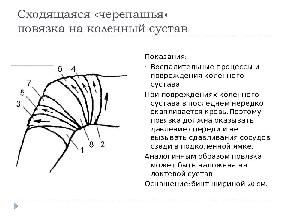 Наложение черепашьей повязки на коленный сустав. Техника наложения черепашьей повязки на коленный сустав. Черепашья повязка на коленный сустав алгоритм. Черепашья сходящаяся на коленный сустав повязка. Наложить повязку на коленный сустав.