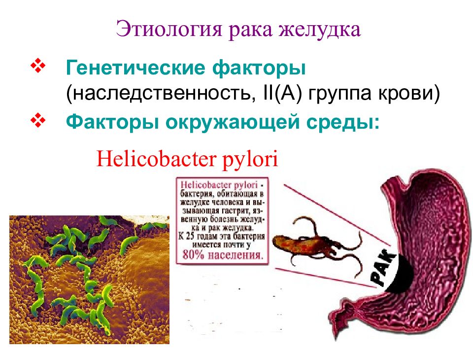 Flot схема при раке желудка