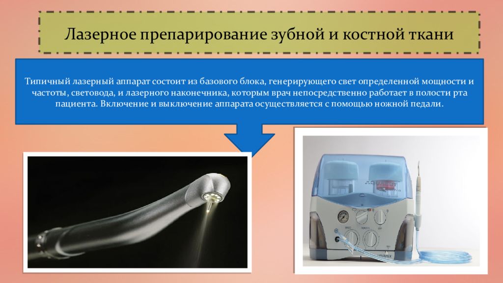 Лазеры в офтальмологии презентация