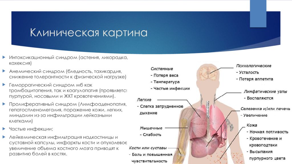 Клиническая картина лейкозов