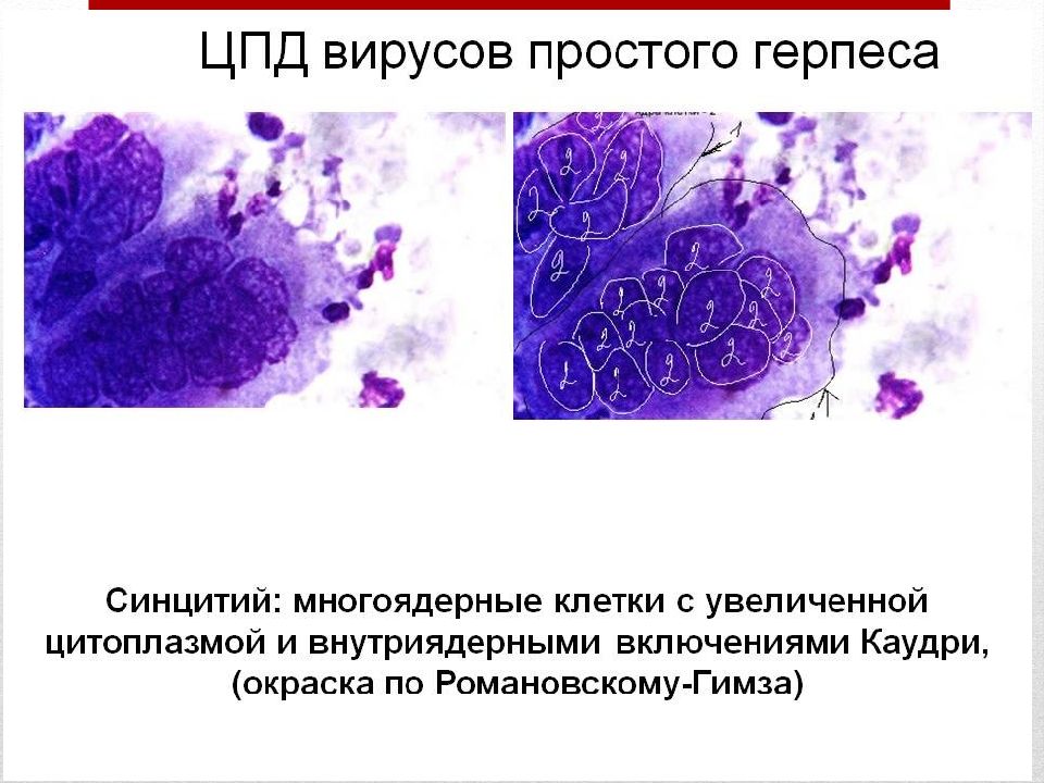 Герпес микробиология презентация