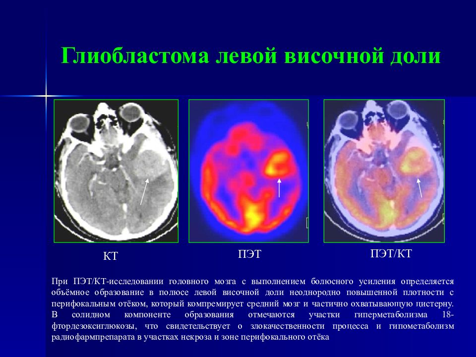 Лучевая диагностика головного мозга презентация