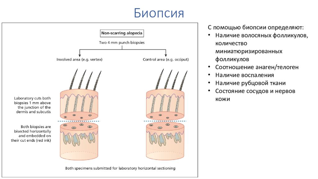 Биопсия кожи