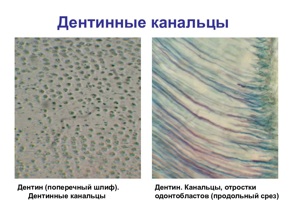 Дентинные канальцы зуба фото