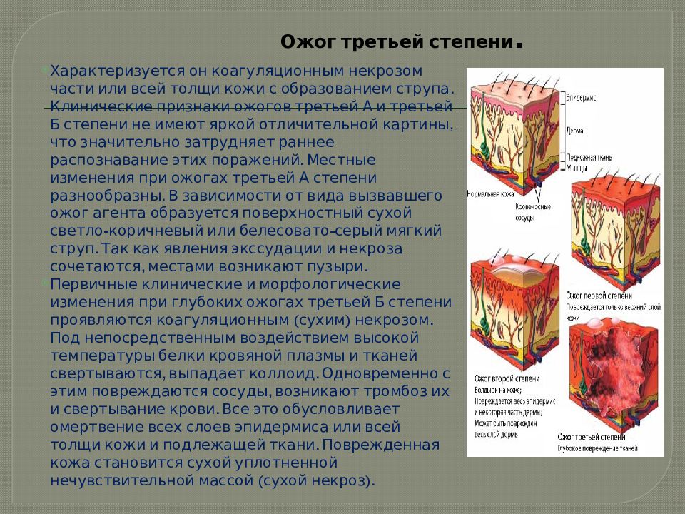 Признаки второй степени термического ожога. Ожог III степени характеризуется. Вторая степень ожога характеризуется. Третья степень ожога характеризуется:.