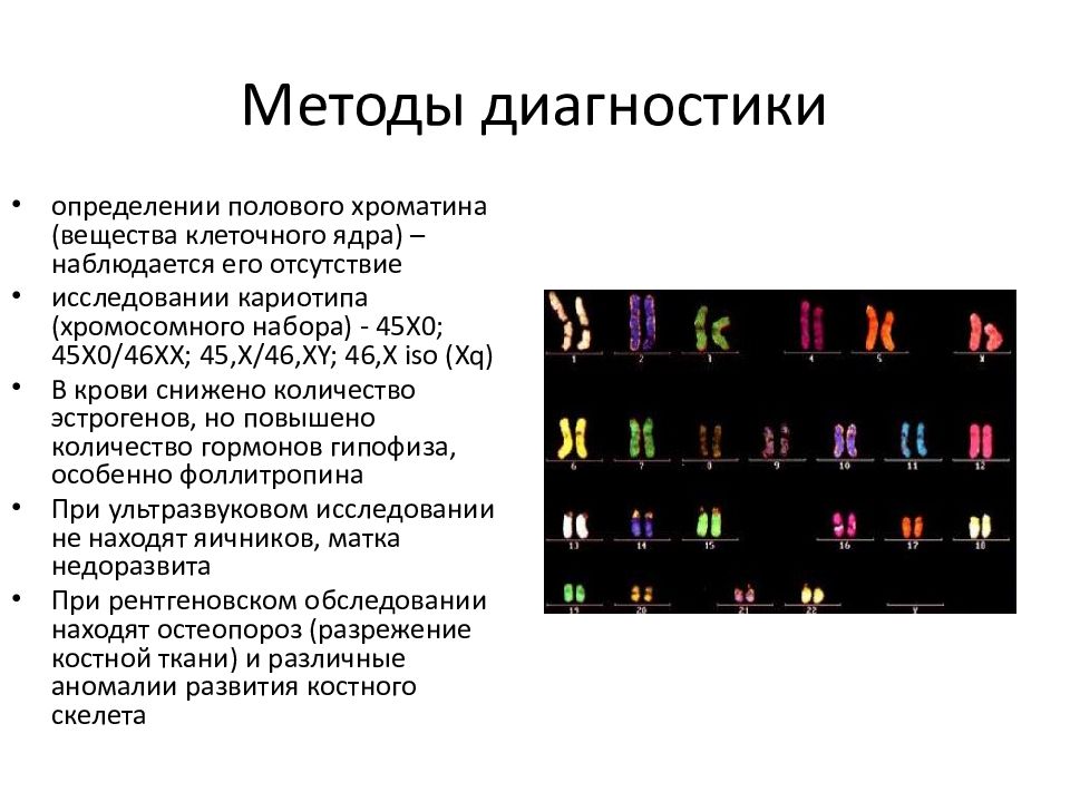 Шерешевского тернера презентация