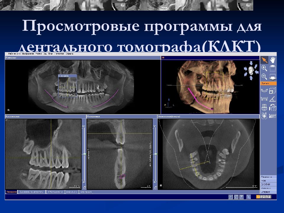 Кт в стоматологии презентация