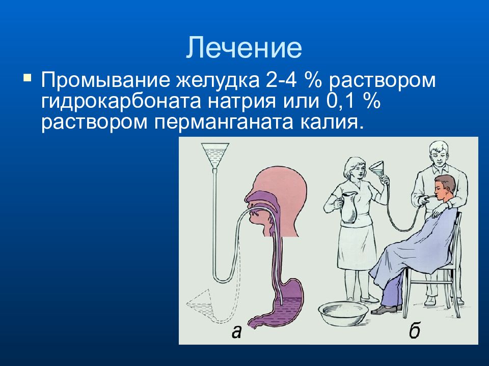 Промывание. Промывание желудка презентация. Презентация на тему промывание желудка. Промывание желудка натрием гидрокарбонатом. Раствор для промывания желудка.