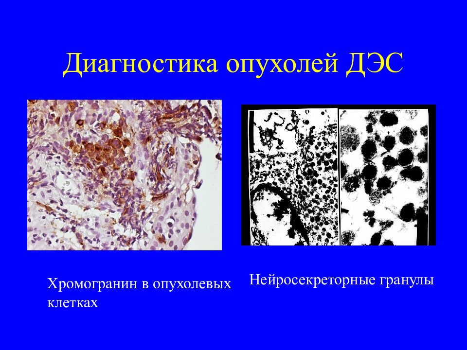 Синдром новообразования презентация