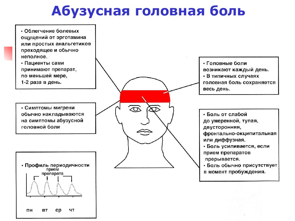 Схема головных болей у человека